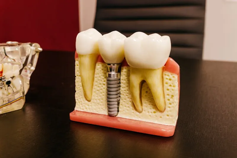 Dental implant components displayed during patient consultation