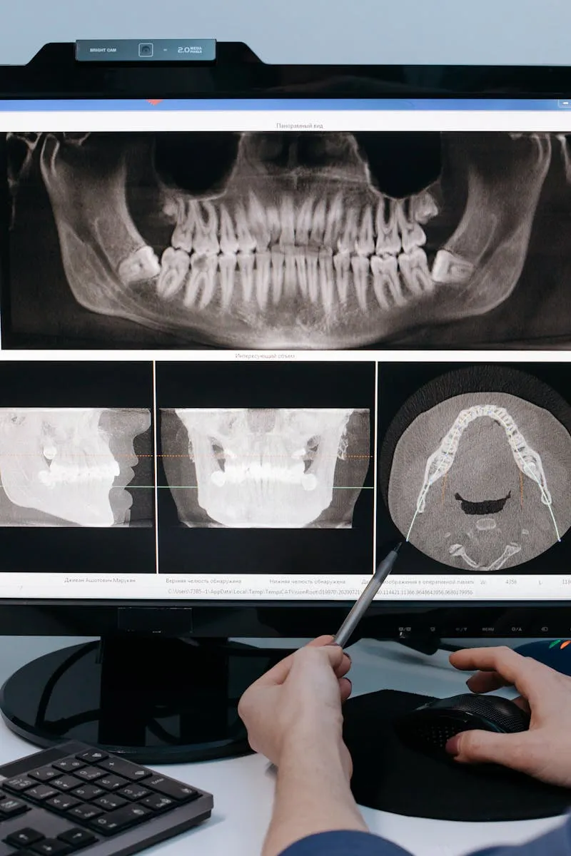 Dentist examining old filling during routine checkup