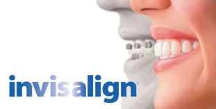 invisalign